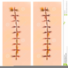 Surgical Stitches Clipart Image