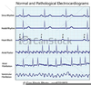 Ekg Clipart Image