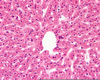 Liver Histology Image