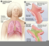 Albuterol Muscle Image