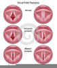 Vocal Cord Clipart Image