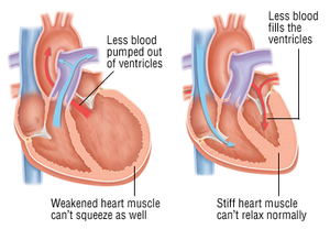 Clipart Heart Valve Image