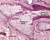 Sebaceous Glands Histology Image