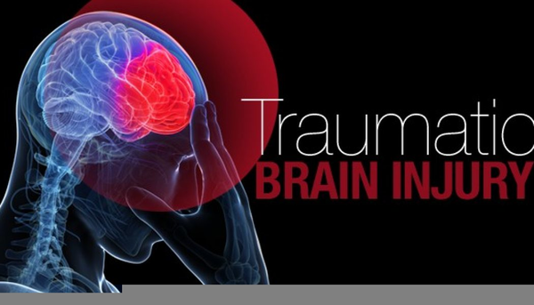 Traumatic Brain Injury Clipart | Free Images at Clker.com - vector clip