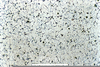 Manganese Steel Microstructure Image