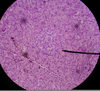 Pancreas Gland Slide Image