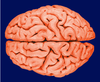 Wet Brain Image