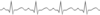 Ecg, Heart Waves Clip Art